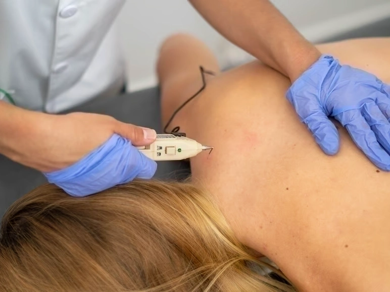 Auto Accident Injury Treatment in Stonecrest, GA